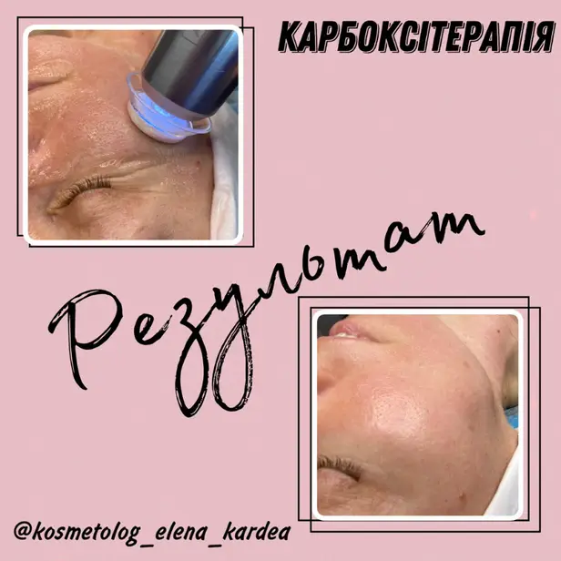 КАРДЕЯ photo 1