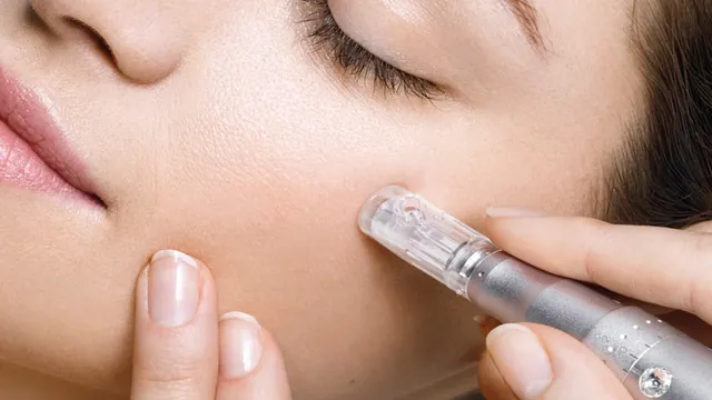 Microneedling Personalizat