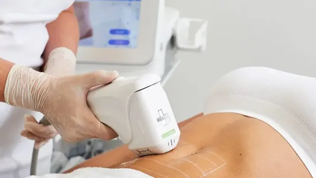 HIFU Corporal Lifting Piele