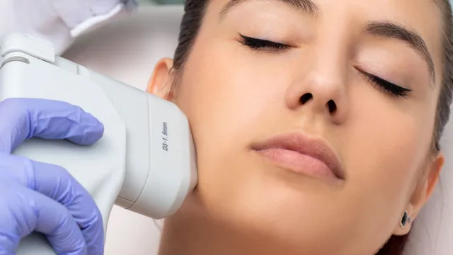 Lifting Facial HIFU