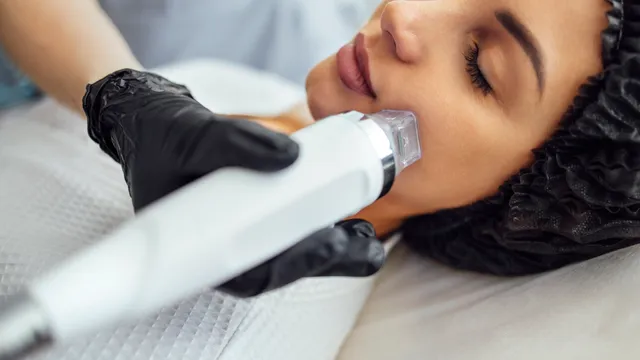 Premium Microneedling RF Exozomi Oxigen