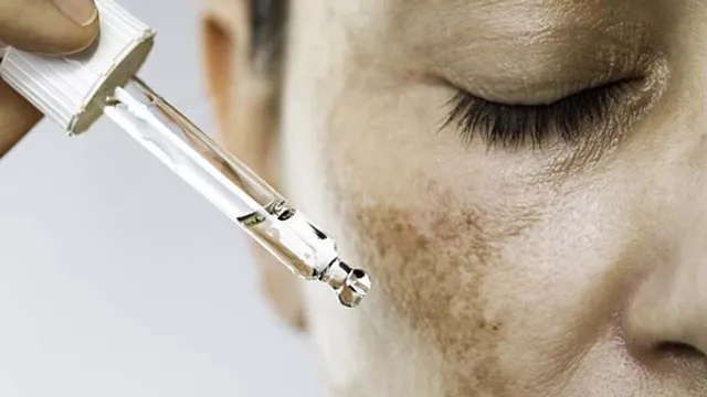 Peeling pentru Pete Pigmentare