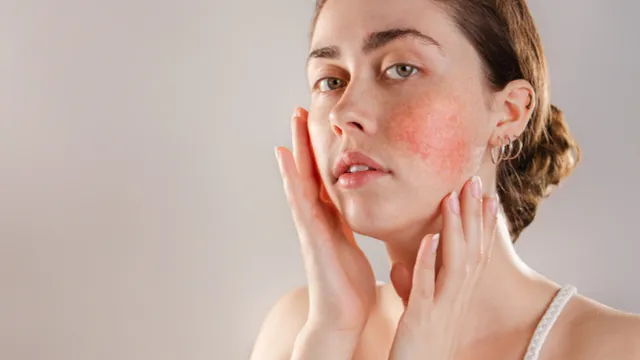 Peeling ten sensibil