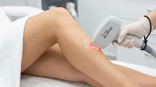 Tehnologia Laser Formatk Alpha