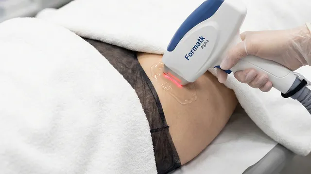 Pachete flexibile Epilare Definitiva