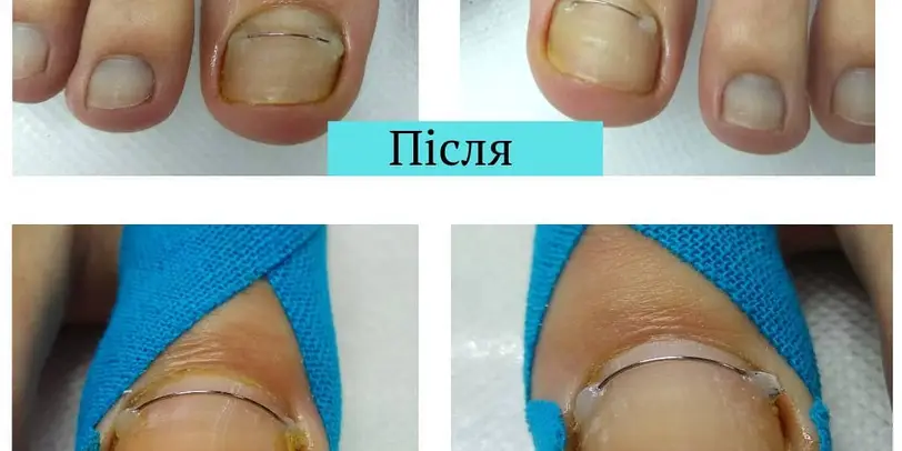 Моя Подологія photo 4