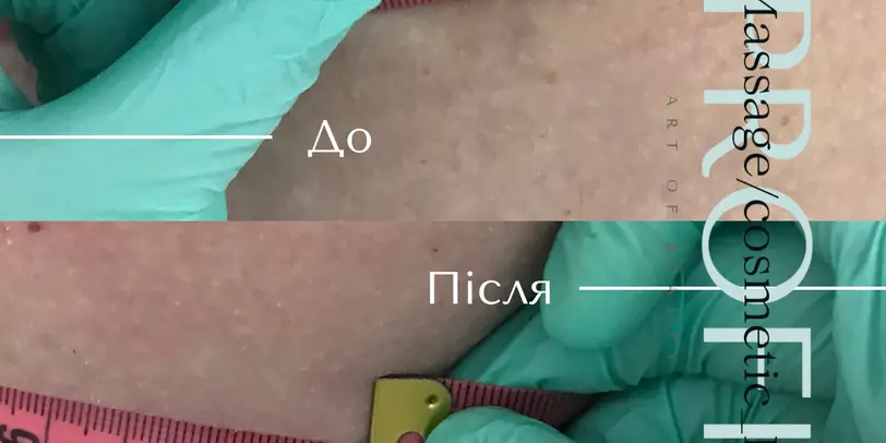 Profi_Massage/cosmetic_IF photo 4