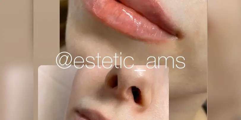estetic_ams photo 16