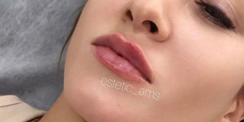estetic_ams photo 19