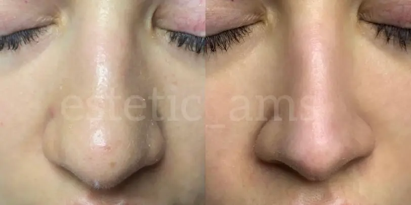 estetic_ams photo 34