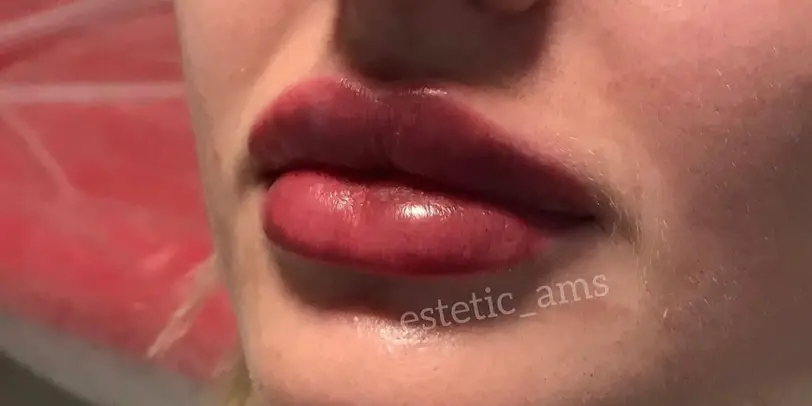estetic_ams photo 28