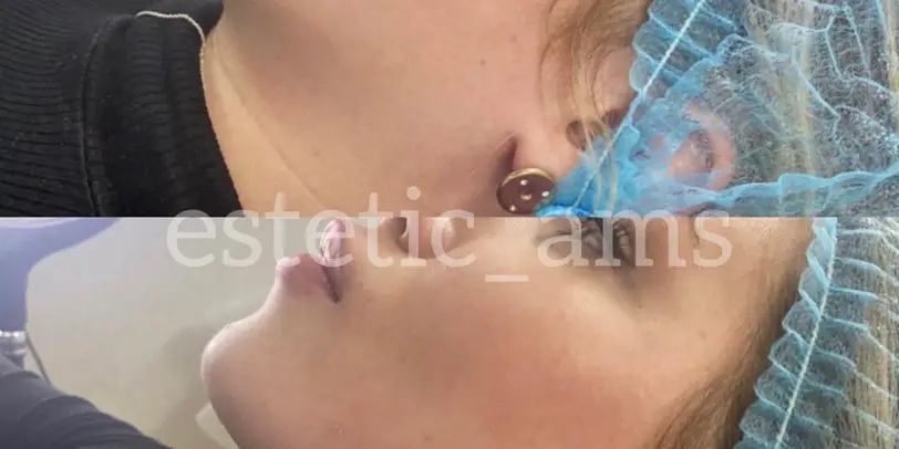 estetic_ams photo 31