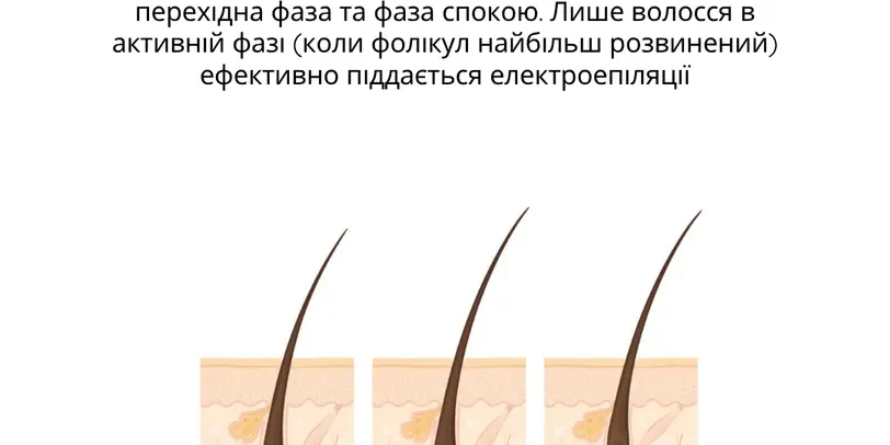 Студія електроепіляції EPIL.KO photo 7