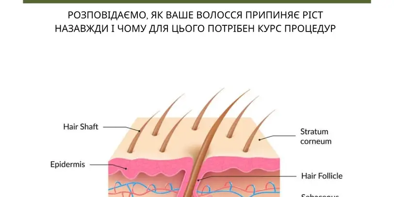 Студія електроепіляції EPIL.KO photo 1