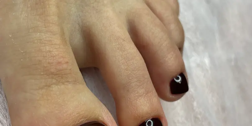 Nailerrry photo 10