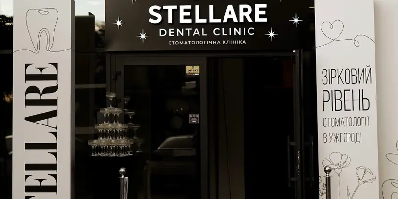 Stellare photo 1