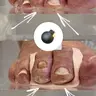 Силіконові ортези