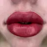 корекція ПМ вуст