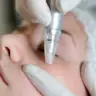 Aquafacial Deluxe + LED Farblichttherapie