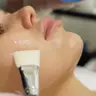 Кислотный Пилинг/peeling