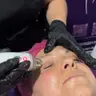 Корекція овалу обличчя