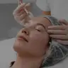 Biorevitalisierung (Skinbooster)