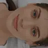 Full Face Behandlung mit Filler