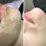 Чистка обличчя