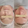 Масаж обличчя