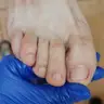 Медичний педикюр