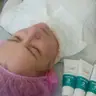 Карбоксітерапія
