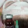 Мезотерапія Рафаело .