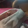 Живий колаген
