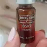 Мезотерапія голови