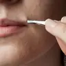 Видалення вусиків