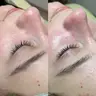 Чистка спини