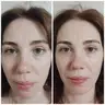 Остеопатична естетика обличчя.