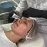Жовтий пілінг