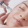 Microneedling