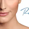 *Контурна пластика обличчя Restylane Defyne