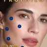 *Ревіталізація Profhilo