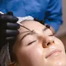 Механічна чистка обличчя
