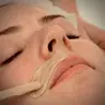 REMOÇÃO DE CERA FACIAL