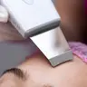 Чистка ультразвукова обличчя