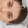 Лоб