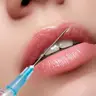 Збільшення губ Stylage M