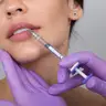 Збільшення губ Juvederm Ultra 3