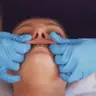 Buccal face massage