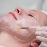 Пілінг PRX-t