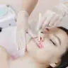 Waxing Gesichtsbehaarung mit Warmwachs